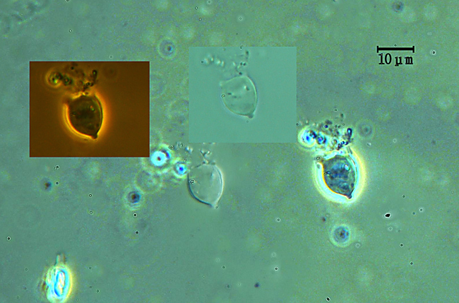 Dendrothele tetracornis Boidin & Duhem